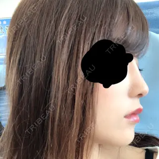 16日目の経過画像（2枚目）