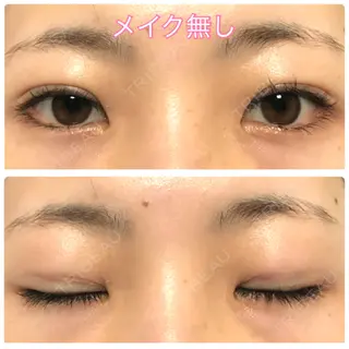 7日目の経過画像（1枚目）