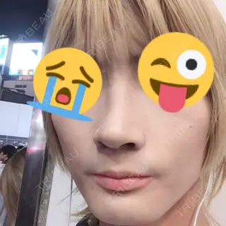 40日目の経過画像（1枚目）