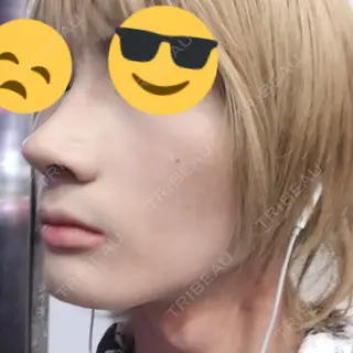 40日目の経過画像（2枚目）