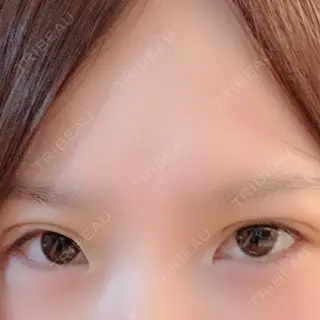 2日目の経過画像（1枚目）