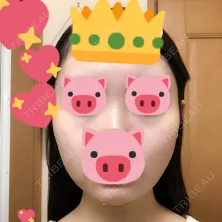 2日目の経過画像（1枚目）