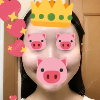 2日目の経過画像（2枚目）