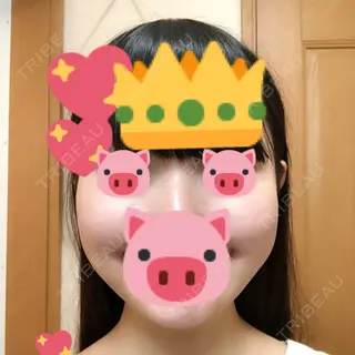 3日目の経過画像（2枚目）