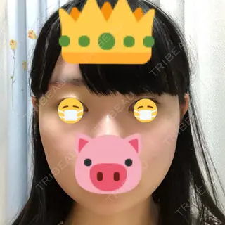 5日目の経過画像（2枚目）