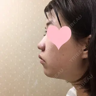3日目の経過画像（2枚目）