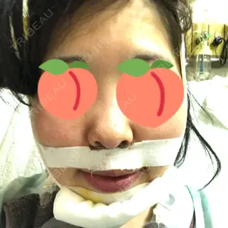 2日目の経過画像（1枚目）