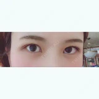 66日目の経過画像（1枚目）