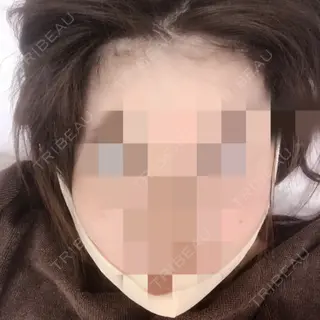 0日目の経過画像（1枚目）