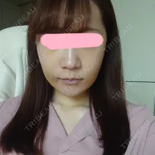 7日目の経過画像（1枚目）