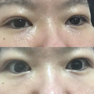3日目の経過画像（2枚目）