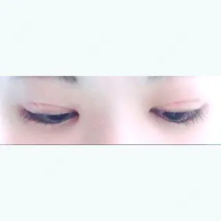 52日目の経過画像（2枚目）