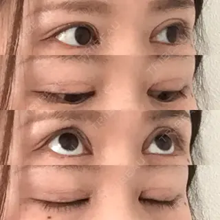 27日目の経過画像（2枚目）