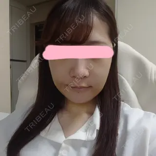 8日目の経過画像（1枚目）