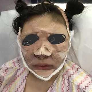 0日目の経過画像（1枚目）
