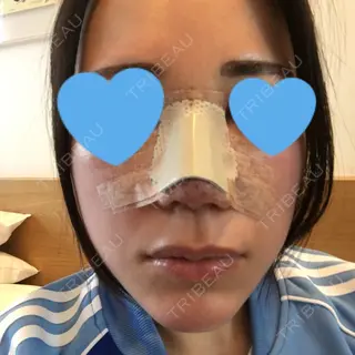 1日目の経過画像（1枚目）