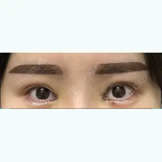 3日目の経過画像（1枚目）