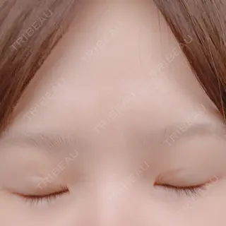 8日目の経過画像（2枚目）
