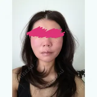 10日目の経過画像（1枚目）