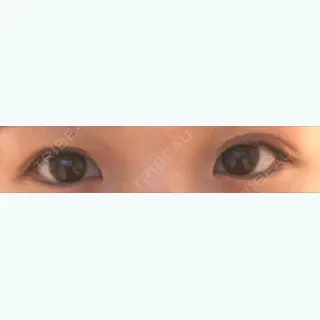 9日目の経過画像（1枚目）