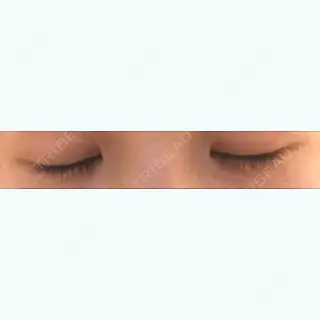9日目の経過画像（2枚目）