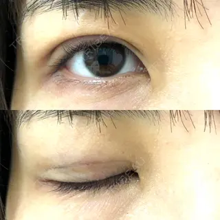 0日目の経過画像（2枚目）