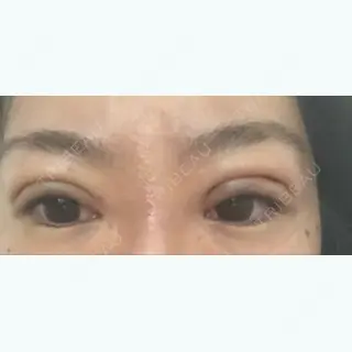 1日目の経過画像（1枚目）