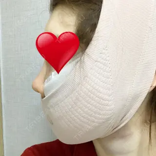 0日目の経過画像（2枚目）