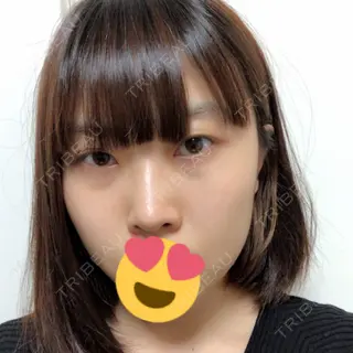 40日目の経過画像（1枚目）
