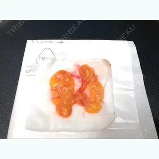 0日目の経過画像（1枚目）