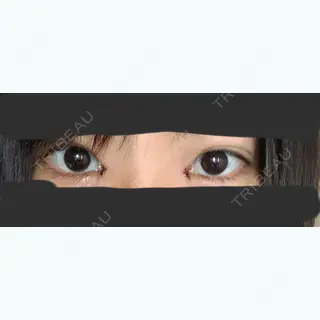 1日目の経過画像（1枚目）