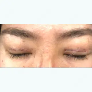 3日目の経過画像（3枚目）