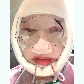 1日目の経過画像（1枚目）