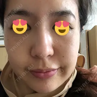 1日目の経過画像（1枚目）