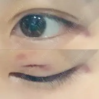 6日目の経過画像（1枚目）