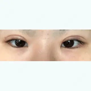 26日目の経過画像（1枚目）