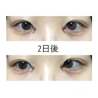 2日目の経過画像（1枚目）