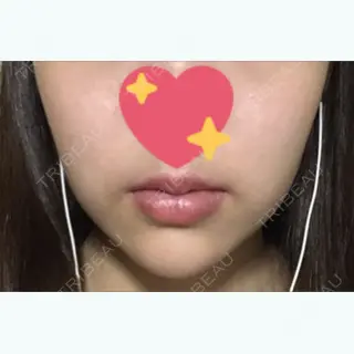 20日目の経過画像（1枚目）