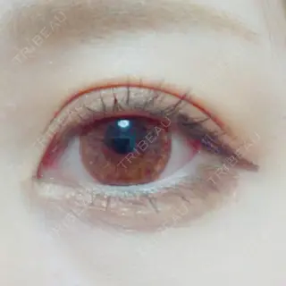 4日目の経過画像（2枚目）