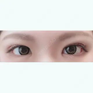 4日目の経過画像（1枚目）