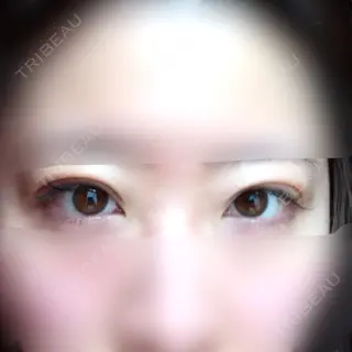 2日目の経過画像（1枚目）