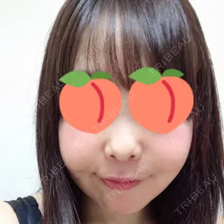 14日目の経過画像（1枚目）
