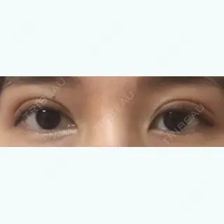 8日目の経過画像（1枚目）