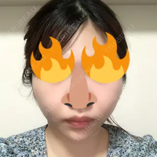19日目の経過画像（1枚目）