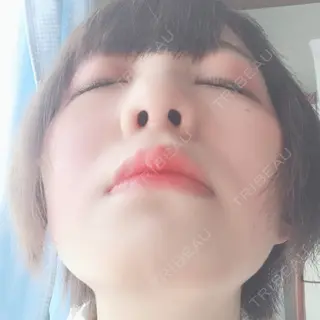 17日目の経過画像（3枚目）
