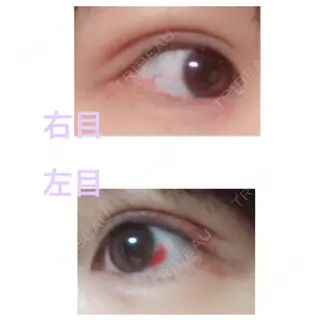 9日目の経過画像（2枚目）