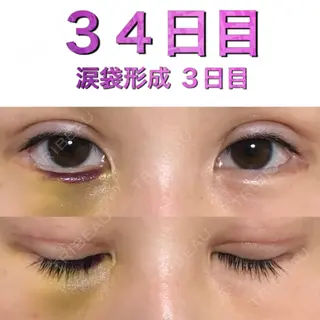 4日目の経過画像（1枚目）