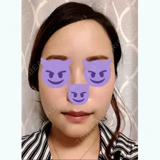 23日目の経過画像（1枚目）
