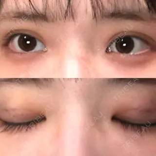 4日目の経過画像（1枚目）