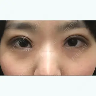 10日目の経過画像（1枚目）